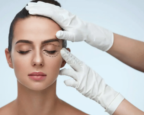Blepharoplasty
