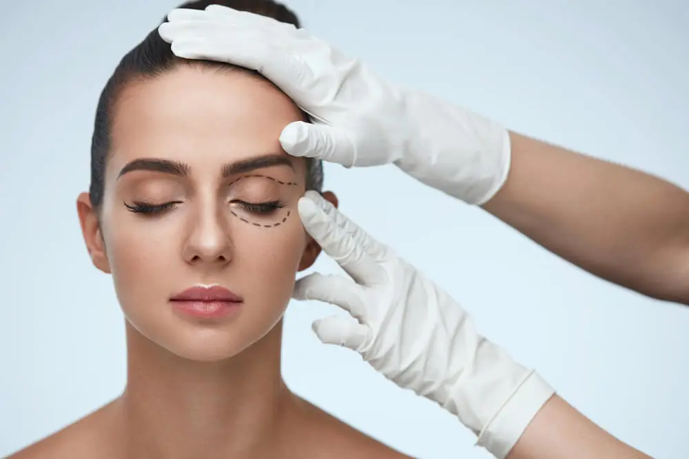 Blepharoplasty