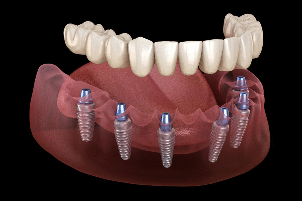 Dental