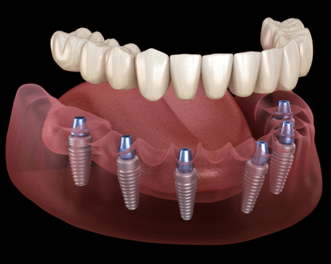 Dental